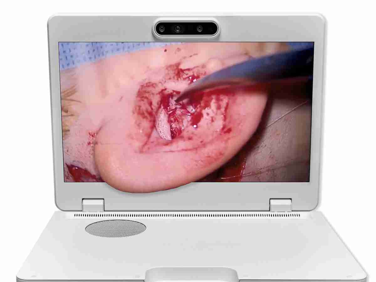 达擎之＂Heads-up 3D显微手术显示系统＂，，，，整合4K裸眼3D显示及眼球追踪系统，，具备快速追踪人眼移动位置功能，，减轻医师长时间维持固定姿势的负担，，，让医师能有更宽广清晰的3D立体视野及更舒适的姿势来执行手术。。